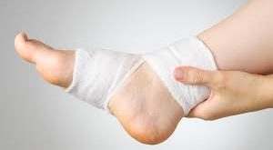 Offenes Bein Hausmittel