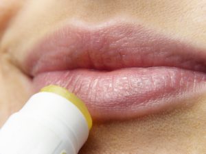 Hausmittel gegen Herpes an der Lippe